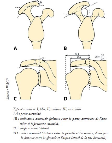 Sans titre