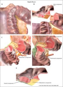 anatomical-components-of-the-hepatic-flexure_osteomag