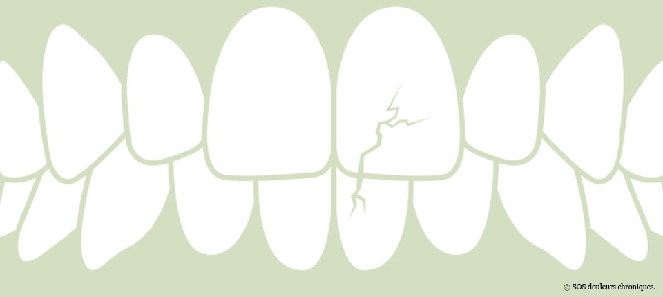 Dysharmonie-occlusale-et-TMD_osteomag28